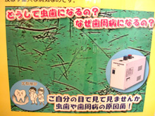 どうして虫歯になるの?なぜ歯周病になるの?ご自分の目で見て見ませんか 虫歯や歯周病の原因菌